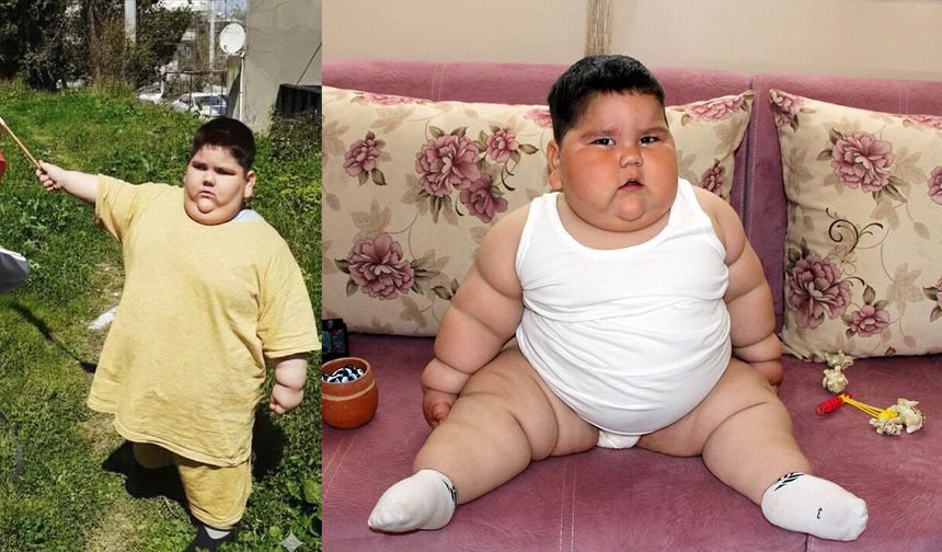5 yaşında 90 kiloydu! Değişimi herkesi şaşkına çevirdi
