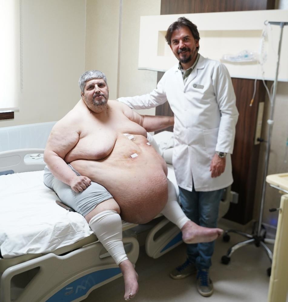 310 Kiloluk Hasta Ilk Adim (1)