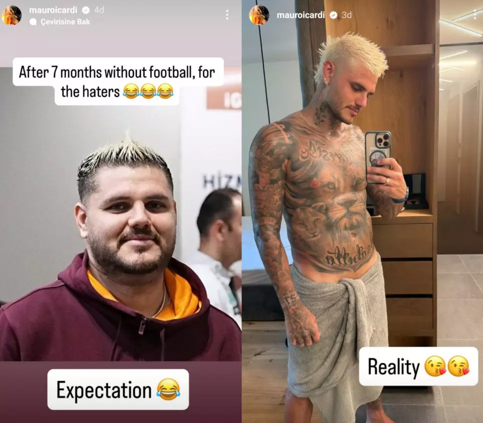 Icardi Kilo Sakatlık Galatasaray