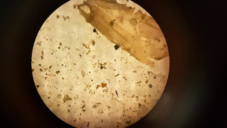 Mikroplastik
