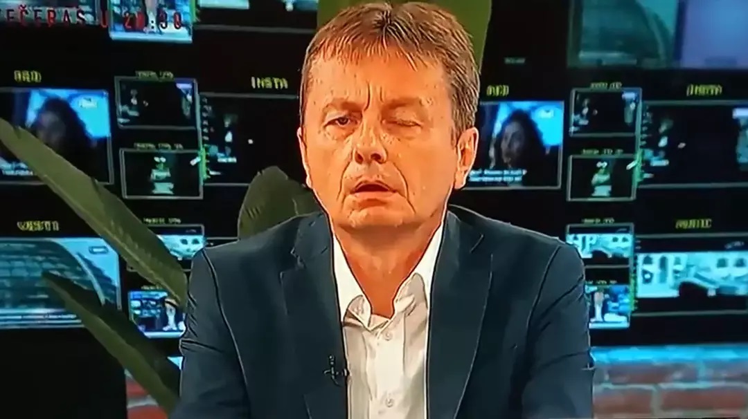 Sırp Bakan Beyin Kanaması Gecirdi