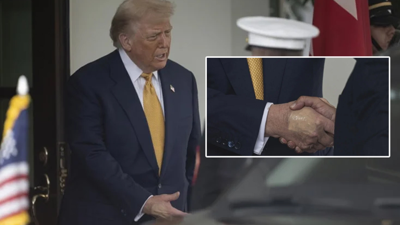 Trump El Sıkısması Morluk Aciklama