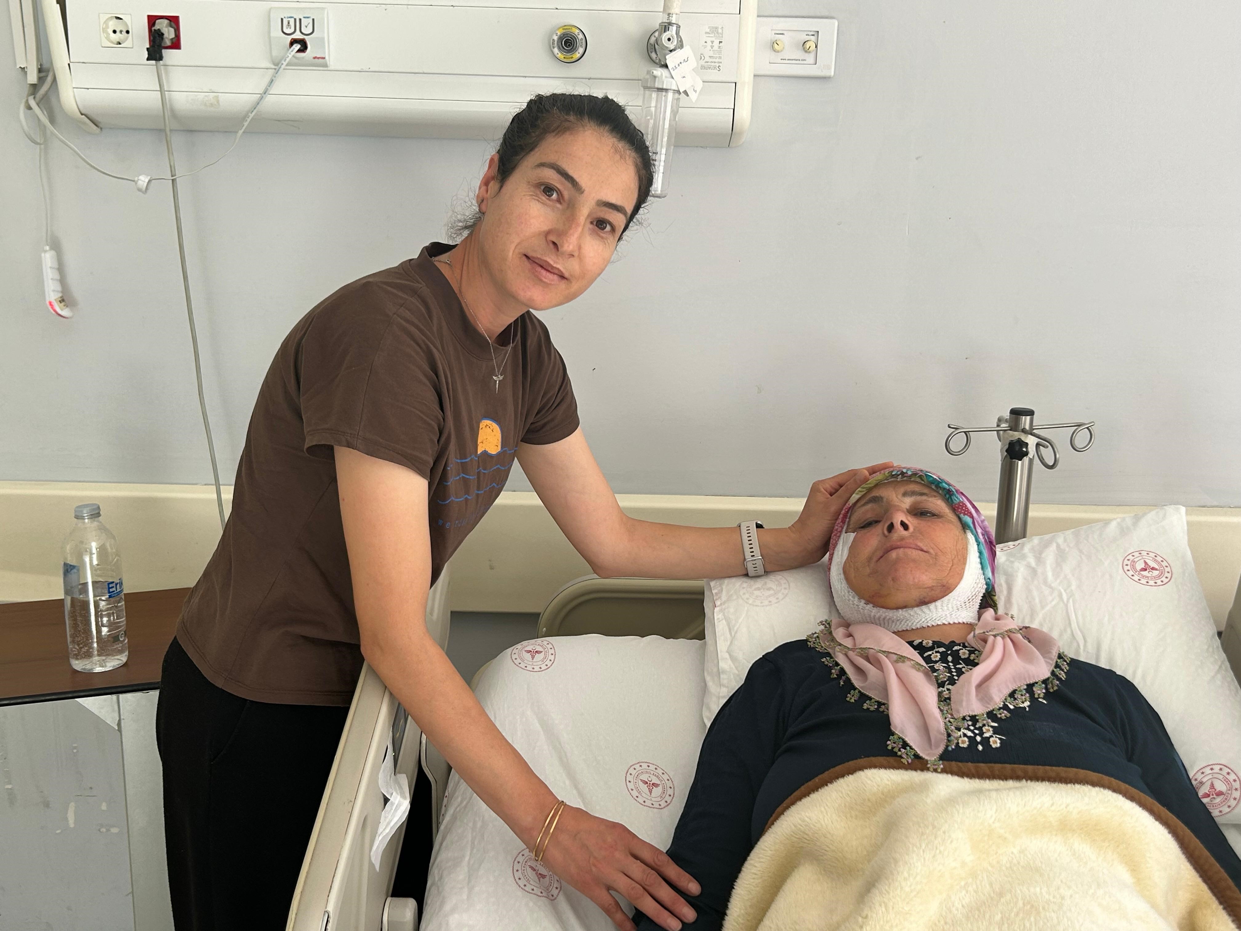 15 Yildir Gulmuyordu Yuz Felci (4)