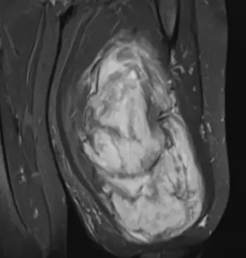 5 Kiloluk Kütle Çıktı.webp 1