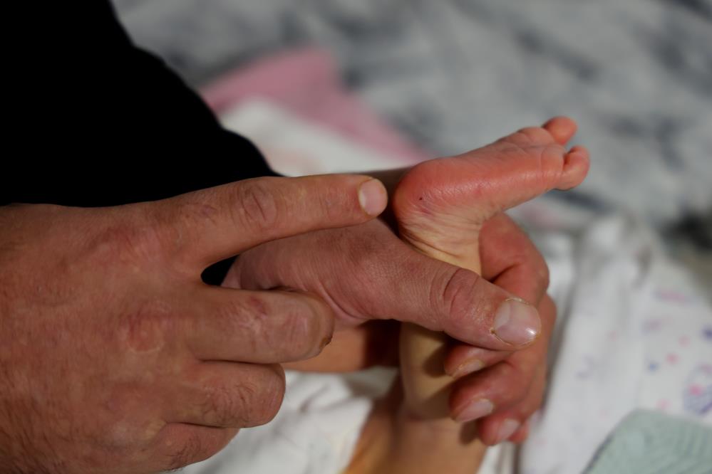 Topuk Kani Bebek Kayyum (3)