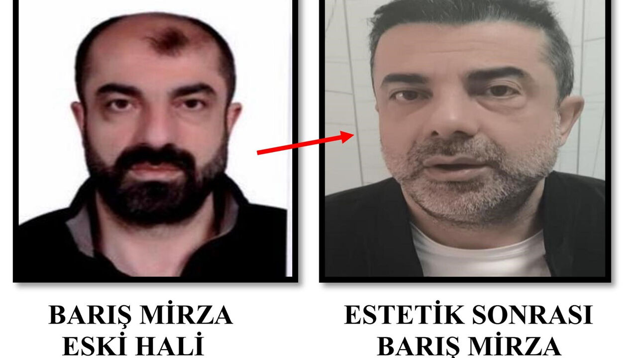 Film değil gerçek! Ameliyatla kardeşinin yüzünü kopyaladı, firari yakalandı