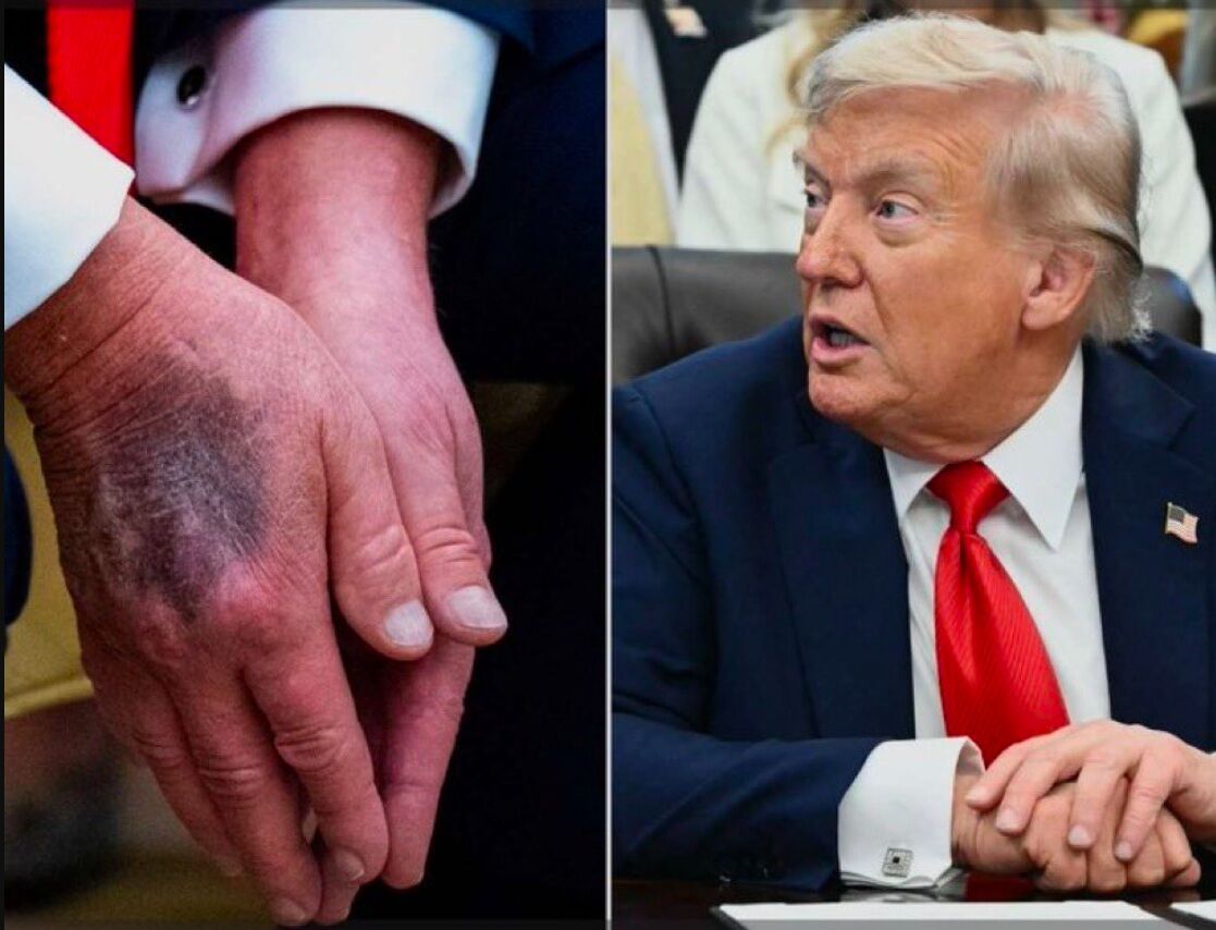 "ABD Başkanı Trump hastaneye kaldırıldı" iddiası...