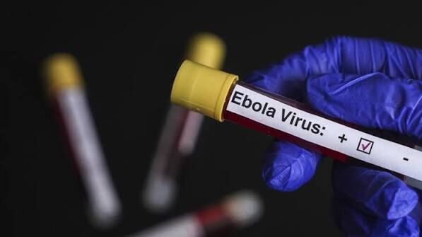 Ebola Virüs