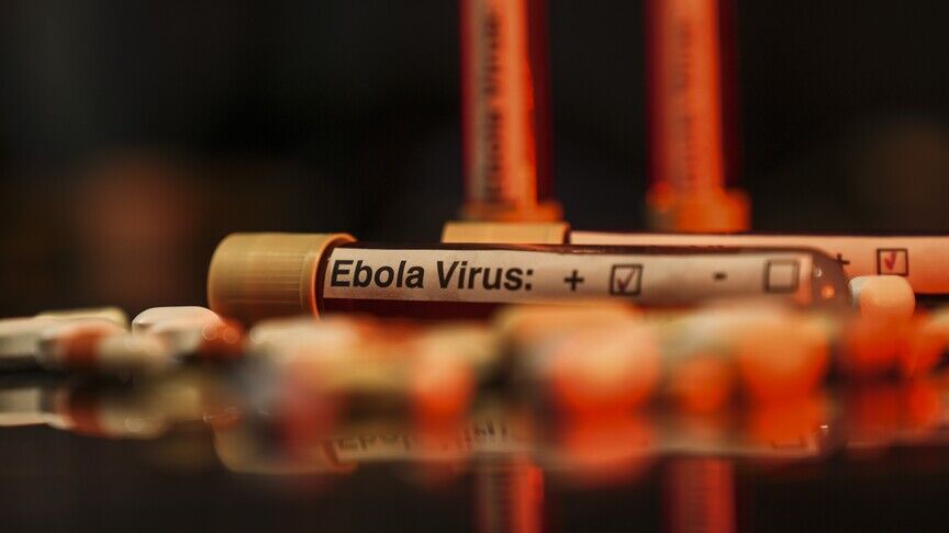 Ebola Virüsü